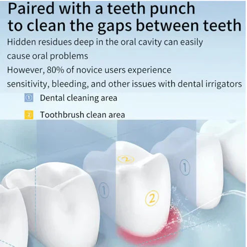 Oral Irrigator – Find Your Beauty
